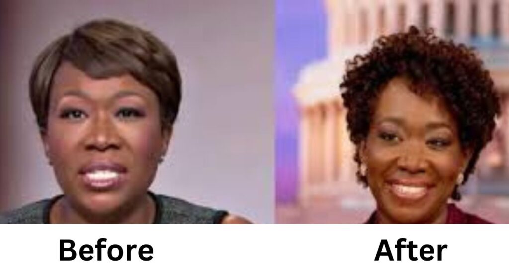 Joy Reid Weight Loss Surgery